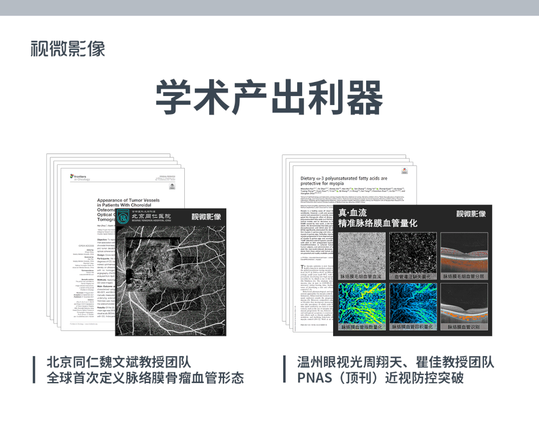登顶中国眼科学十大进展领跑国产高端眼科设备视微靠什么？(图4)